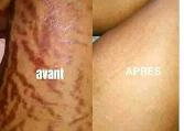Soin de la peau