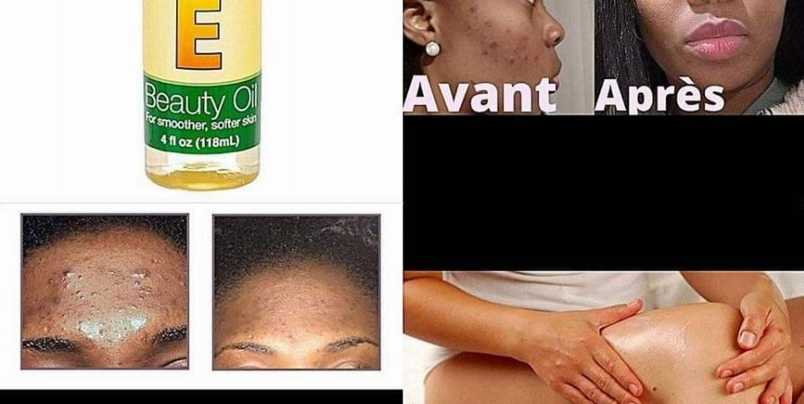 Soin de la peau